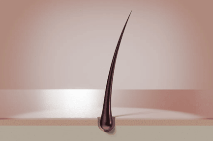 Haar Transplantation 