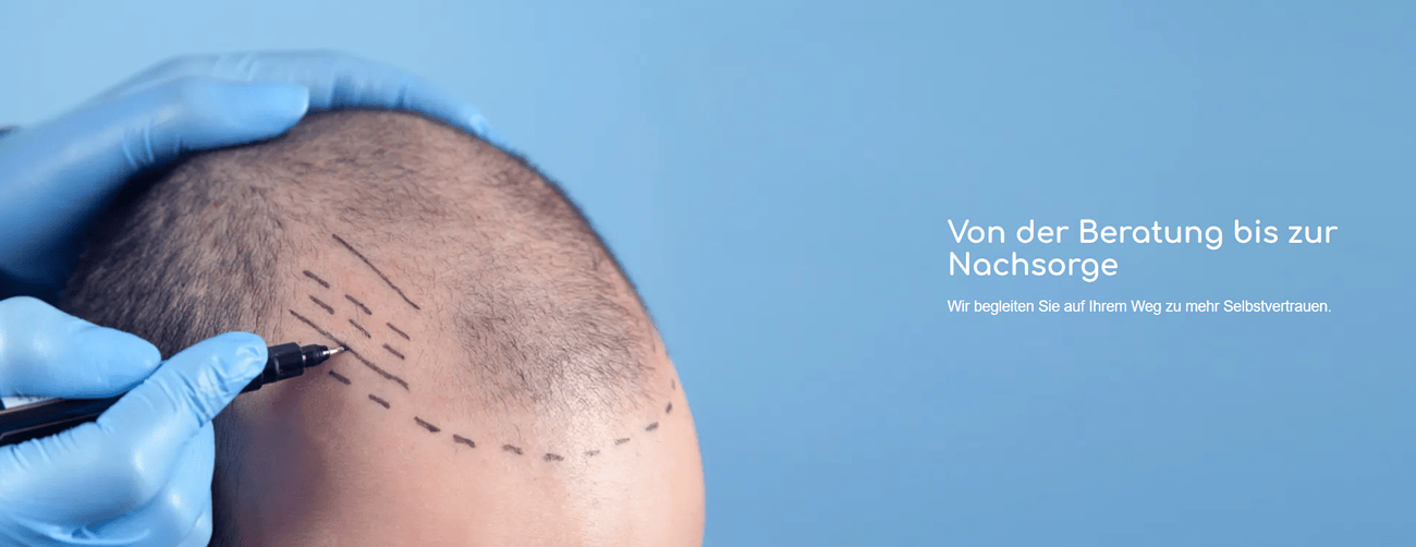 Haartransplantation Stuttgart - ↗️HaarÄsthetiX: ✔️Botox, Haarausfall, Laserbehandlung, Schönheitsklinik
